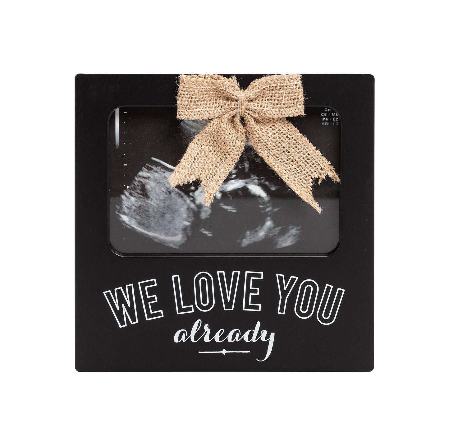 We Love You Already Sonogram Photo Frame, Black